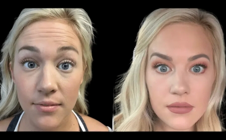 Seasonal Botox Trends According to the Best Doctors in Dubai