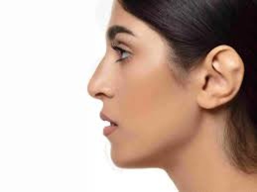 Otoplasty in Jeddah: Reshape Your Ears for a Balanced Facial Look