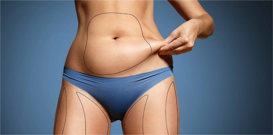 Abdominoplasty in Dubai: The Importance of Post-Surgery Care for a Smooth Recovery