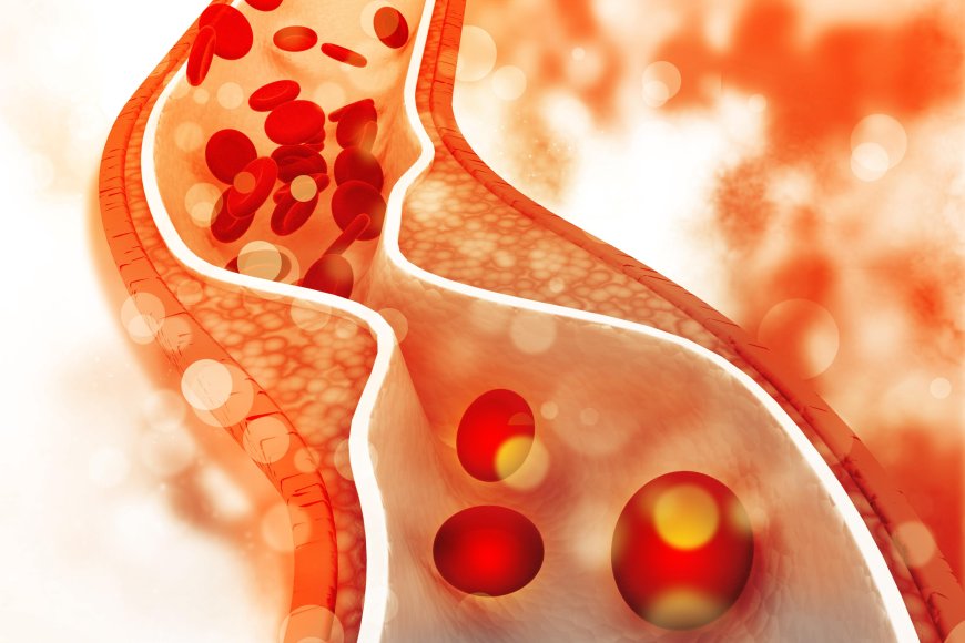 Is Your Diet Contributing to High Cholesterolemia in Dubai? Expert Tips