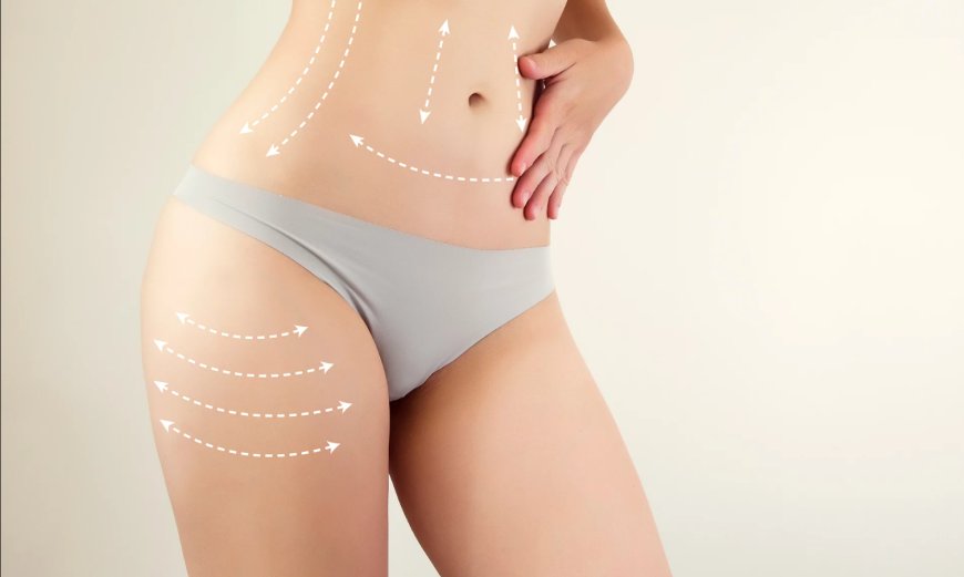 After Liposuction in Dubai Your Ultimate Guide to Healing and Body Contouring