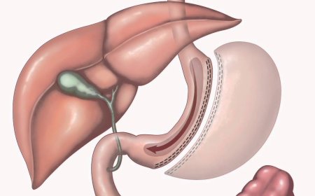 How Do I Involve My Family in My Bariatric Surgery Journey in Dubai?