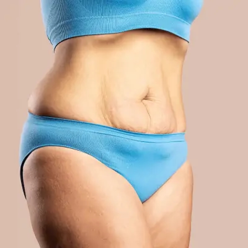 Why Experience Matters When Choosing the Best Tummy Tuck Surgeon in Dubai