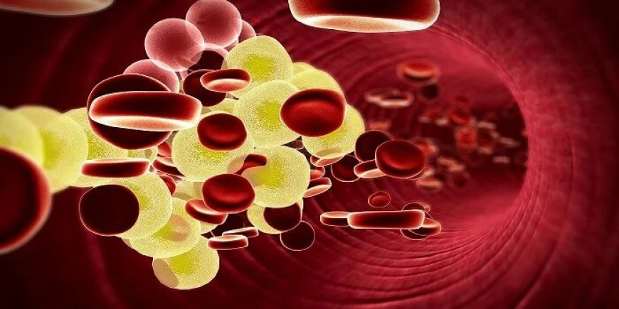 Screening and Prevention of High Cholesterolemia in Dubai