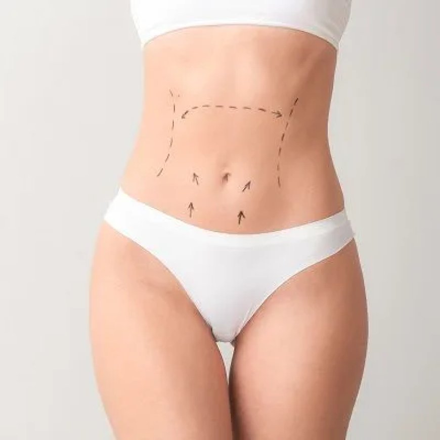 Do I Need to Stay Overnight After a Mini Tummy Tuck in Dubai?