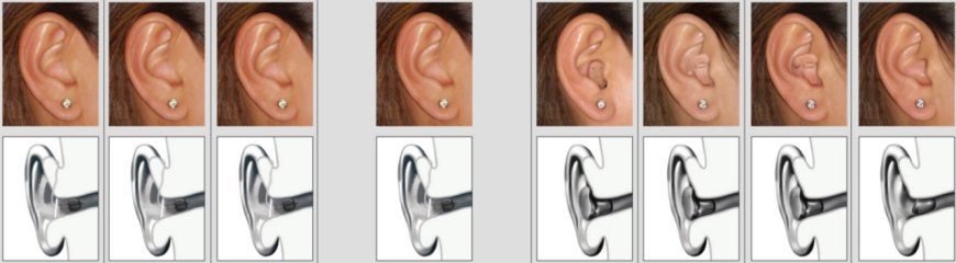 Buy Hearing Aids in Muscat – Trusted Hearing Care for a Better Tomorrow