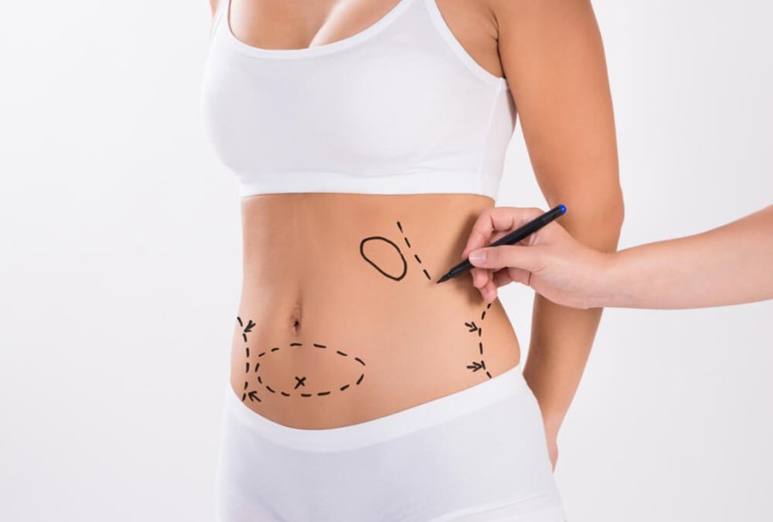 Understanding Liposuction Surgery Psychological Impact in Dubai